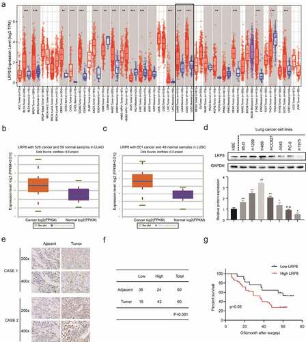 Figure 1. LRP8 is related to the poor prognosis of NSCLC patients. (a–c) Expression of LRP8 in NSCLC tissues as analyzed by TIMER and StarBase3.0 databases. (d) Western blotting assays to detect the expression of LRP8 in seven NSCLC cell lines and the normal bronchial epithelioid cells. (e) Immunohistochemistry staining of two representative cases showing the expression and location of LRP8 in NSCLC tissues. (f) Four-grid table showing the statistical difference of LRP8 level between tumor tissues and normal adjacent tissues. (g) Kaplan–Meier curve based on LRP8 expression in 60 NSCLC patients (log-rank test, p < 0.05). n.s, no significant difference, *p < 0.05, **p < 0.01. At least three independent biological experiments were repeated, and the data were presented as mean ± SD.