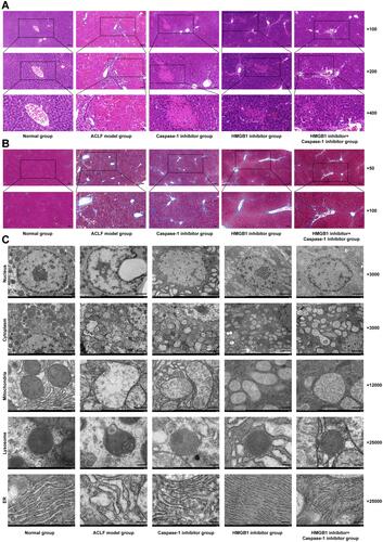 Figure 4 Pathological damage of liver tissue in each group.