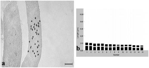 Figure 10. Klasea cerinthifolia. (a) Metaphase chromosomes (scale bar 10 μm); (b) idiogram.