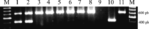 Figure 2. Representative WSSV electrophoretic band patterns from frozen shrimp sections. There are presented two representative WSSV analyses conduced in frozen sections from main and more abundant shrimps stocks of this study. Lanes M: 1 kb ladder; Lane 9: water template (negative control); Lane 10: WSSV-positive cDNA (401 bp-positive control); Lane 11: PCR-Reaction internal control (602 bp-positive control); Lanes 1 and 2: positive samples from P. aztecus imported from USA; Lanes 3 and 4: Samples from L. vannamei produced in Venezuela; Lanes 5 and 6: Samples from L. vannamei produced in USA; Lanes 7 and 8: Samples from Penaeus duorarum produced in USA. Figura 2. Patrón de bandas electroforético característico del WSSV obtenido a partir de secciones de camarón congeladas. Se presentan dos análisis representativos del diagnostico WSSV realizados en las principales y más abundantes secciones de camarón congeladas. Carril M: Marcador 1 kb; Carril 9: Solo agua (testigo negativo); Carril 10: ADNc positivo al WSSV (Testigo positivo de 401 pb); Carril 11: Testigo interno de la reacción de PCR (Testigo positivo 602 pb). Carriles 1 y 2; Muestras positivas de P. aztecus importado desde los EUA. Carriles 3 y 4; Muestras de L. vannamei producidas en Venezuela. Carriles 5 y 6; Muestras de L. vannamei producidas en EUA. Carriles 7 y 8; Muestras de Penaeus duorarum producidos en EUA.