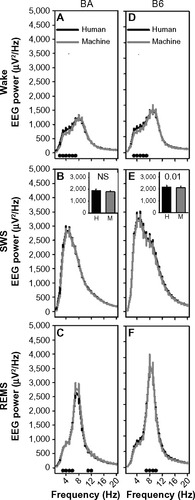 Figure 6 Machine-scored data in 10-second epochs exhibit similar frequency profiles to human-scored data.