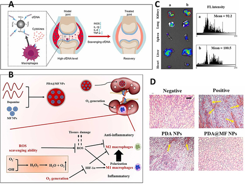 Figure 7 (A) Schematic illustration of in vivo RA therapy effect of dimethylamino group (3- dimethylamino- 1- propylamine (M) or 3, 3- iminobis (N, N- dimethylaminopropyl) (B)) modified polydopamine (DPs). The DPs were intra articular (IA) injected into the knee joint of CIA rat and strongly bound with cfDNA to lower the expression of inflammatory factors: MMP-13, TNF-α, IL-6 and IL-1β for RA therapy. Reproduced from Chen Y, Wang Y, Jiang X, et al. Dimethylamino group modified polydopamine nanoparticles with positive charges to scavenge cell-free DNA for rheumatoid arthritis therapy. Bioact Mater. 2022;18:409–420. Citation160 Copyright © 2022 KeAi, open access. (B) Schematic illustration of PDA@MF NPs treatment for ROS-related kidney diseases.Citation161 (C) Bio-distribution of PDA NPs and PDA@MF NPs was examined via in vivo imaging instruments.Citation161 (D) H&E analysis of kidneys in different groups.Citation161 Adapted from Zheng B, Deng G, Zheng J, et al. Self-polymerized polydopamine-based nanoparticles for acute kidney injury treatment through inhibiting oxidative damages and inflammatory. Int J Biochem Cell Biol. 2022;143:106141. Citation161 Copyright © 2022, with permission from Elsevier.
