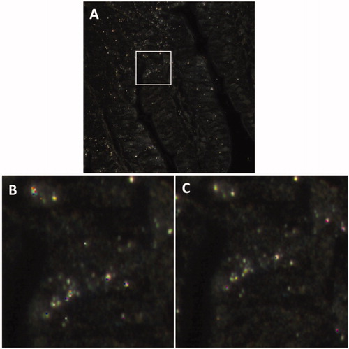 Figure 5. Comparison of two material specific reference spectral libraries: obtained from a treated mouse or from the SAS stock dispersion. The hyperspectral microscopy images correspond to a jejunum section of a mouse treated with 1000 mg/kg b.w. 100 nm porous SAS from the follow-up group (26 days). (B) and (C) are magnifications of image (A) white contour square area, analyzed using a RSL obtained from jejunum sections of a treated mouse (B) or using a RSL obtained from the stock SAS dispersion (C).