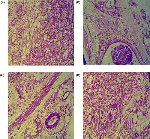 Figure 11. Histopathological images of rat ankle joint tissues stained (lower row) with hematoxylin and eosin under different treatment (A) Control, (B) CFA (Toxic control), (C) Diclofenac gel and (D) MNF-TEopt gel. Arrows show inflammatory cell infiltration.