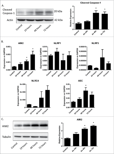 Figure 2. Arsenic activates AIM2 inflammasome in HaCaT cells. (A) HaCaT cells were treated with sodium arsenite at 2 µM for 24, 48 or 72 h. Expressions of cleaved caspase-1 were detected by Western-blot. (B) Real-time PCR showed the mRNA level of AIM2, NLRP1, NLRP3, NLRC4 and ASC in HaCaT cells after arsenic treatment. (C) The protein level of AIM2 was determined by Western-blot and quantified by densitometry. (D) HaCaT cells were transiently transfected with AIM2-shRNA plasmids. The downregulation of AIM2 was determined by Western-blot. (E) Control or AIM2-knockdown HaCaT cells were treated with arsenic for 24 h. The levels of cleaved caspase-1 were determined by Western-blot. Cytokine secretions in the media of arsenic-treated or control cells were determined by ELISA. The experiments were repeated three times. Data are represented as mean ± SEM of three experiments. *p < 0.05 vs. control.