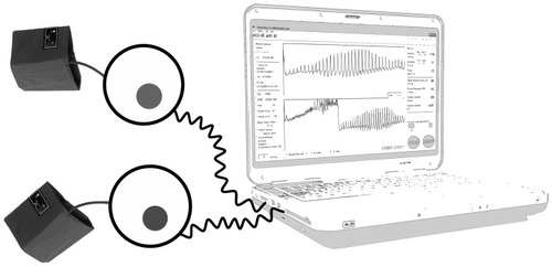 Figure 1 SCVL® system.