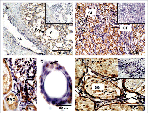 Figure 6 Expression of PrPC in bovine lung, kidney and skin. (A) PrPC-specific labeling was observed associated with the alveolar wall (W) (arrow) (Alveolar Sacs, S; Pulmonary Artery, PA). (B) In kidney, PrPC immunoreactivity is associated with glomeruli (Gl), proximal convoluted tubules (CT) and collecting ducts in the medulla. (C) Higher magnification of renal glomeruli shows strong PrPC staining in extraglomerular mesangial cells (EMC). (D) PrPC staining in the skin is associated with epidermal cells in hair follicles (arrow). (E) Staining was also present in sebaceous glands (SG) located in the dermis. Inserts represent serial section incubated with non-immune horse serum instead of SAF-32 antibody (negative control).
