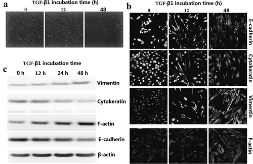 Figure 1. TGF-β1-stimulated EMT in 8505C cells. (a) Time effect of TGF-β1 on EMT were examined by morphologic changes in 8505C, 200× magnification. (b) Immunofluorescence stains: Cultured 8505C cells after TGF-β1 treatment were stained with monoclonal antibodies against E-cadherin, cytokeratin, vimentin and F-actin. (c) Expression EMT markers in TGF-β1–stimulated 8505C cells was detected by western blot assay.