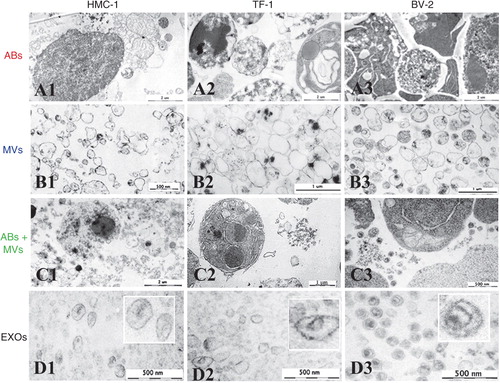 Fig. 5 Analysis of ABs, MVs and EXOs by TEM. Micrographs of vesicles released from three different cell lines; HMC-1 (human mast cell line), TF-1 (human erythroleukemia cells), and BV-2 (mouse microglia cells) are shown. (A1–3) Dense structures show the chromatin substance in the generally round shaped apoptotic bodies (ABs) with a size of 800–5,000 nm. (B1–3) Microvesicles (MVs) are diverse in their shape and density, with a size range between 200 and 800 nm. (C1–3) In the pellet obtained by centrifugation at 16,500×g presents the mixture of ABs and MVs. (D1–3) The exosome (EXO) fraction from HMC-1 (D1), TF-1 (D2) and BV-2 (D3) cells were found to have a diameter of approximately 40–100 nm.