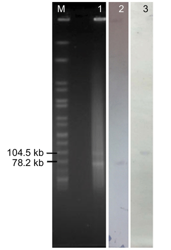 Figure 1 S1-digested plasmid DNA and southern blot hybridization of the E. coli EC1188 isolate.