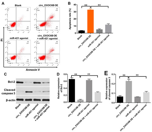 Figure 5 Overexpression of circEXOC6B induced the apoptosis of ovarian cancer cells. SKOV3 cells were treated with circEXOC6B-shRNA2 or/and miR-421 antagonist for 72 h. (A, B) Apoptotic cells were detected with Annexin V and PI double staining. (C) Expression levels of Bcl-2 and cleaved caspase 3 in SKOV3 cells were detected with Western blotting. (D, E) The relative expressions of Bcl-2 and cleaved caspase 3 in SKOV3 cells were quantified via normalization to β-actin. **P < 0.01.