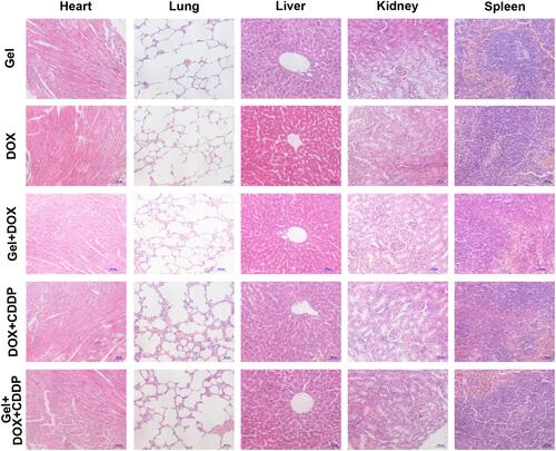 Figure 5 Histological H&E staining of the mice organs after different treatments: Gel, DOX, Gel+DOX, DOX+CDDP and Gel+DOX+CDDP.