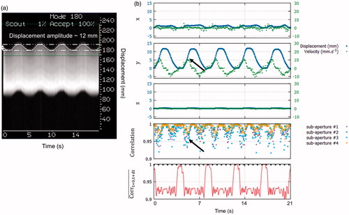 Figure 4. Displacement estimation validation in vitro. (a) MR-navigator signal positioned along the y-axis acquired during 21 s. (b) Representative displacement estimations in (x→,y→,z→) obtained in vitro using our experimental settings. The blue and green curves represent the displacement estimations and the corresponding instantaneous speed computed from estimated positions, respectively. The bottom graph displays the normalised cross-correlations between two successive US acquisitions along time, for each sub-apertures. Black arrows depict lower normalised cross-correlation coefficients during peak velocities. On the bottom graph, the red curve represents the mean correlation between current measurement and the first acquisition taken as reference. The black dashed line represents the threshold above which absolute displacement estimations is performed to reset the position. (Colored version is available on the journal’s webpage).
