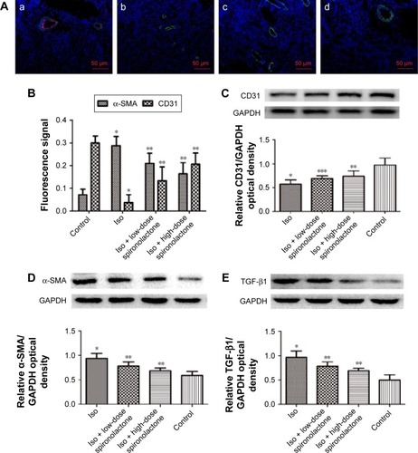 Figure 3 Expression of CD31, α-SMA, and TGF-β1 proteins in rats.