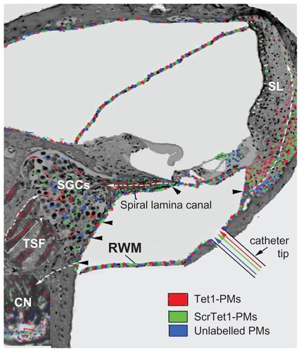 Figure 2 Illustration of the distribution of the polymersomes (PMs) after delivery using cochleostomy. In the cochlear nerve within the spiral lamina canal, the cochlear nerve in the tractus spiralis foraminosus region, and the spiral ligament (SL), the distribution patterns of Tet1-PMs, ScrTet1-PMs, and unlabelled PMs were different.Notes: Arrowheads, the openings in ST that allowed the PMs to pass through.Citation19 White arrows with dashed lines, the possible routes of PM distribution in the inner ear.Abbreviations: Tet1-PMs, Tet1-functionalized PMs; ScrTet1-PMs, scrambled Tet1 peptide modified PMs; RWM, round window membrane; SGCs, spiral ganglion cells; CN, cochlear nerve.