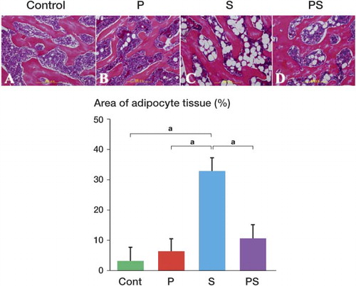 Figure 2. Area of adipocytes in the bone marrow. The pictures in the upper row show that the adipocyte area in the bone marrow of the femoral head epiphysis was larger in group S (panel C) than in groups PS (panel D), C (panel A), or P (panel B) (stain: hematoxylin and eosin; original magnification: ×100). In the lower panel, the percentage area of adipocyte tissue in the bone marrow is compared for the 4 groups (see Results). Error bars indicate SD. a p < 0.001 (Fisher's exact test).