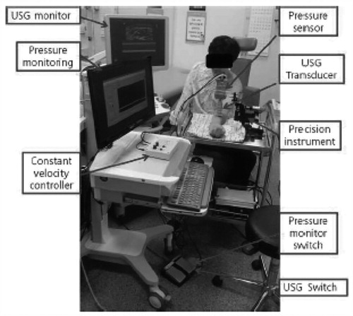 Figure 2. Ultrasonography (USG) with a linear transducer equipped with a pressure sensor was used to evaluate lymphedema tissue. Using a constant velocity controller, the arm was compressed down at a constant velocity using a precision instrument (0.8 mm/sec). The pressure signal was recorded in the computer using a data acquisition system.