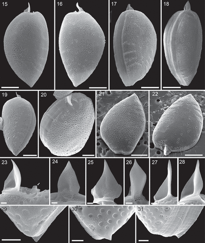 Figs 15–31. Prorocentrum micans (strain A10, SEM). Figs 15–20. Entire cells in right thecal view (Fig. 15), left thecal view (Fig. 16), ventral-lateral view (Fig. 17), dorsal-lateral view (Fig. 18), left thecal view (Fig. 19) and apical view (Fig. 20). Figs 21, 22. Left thecal plate (Fig. 21) and right thecal plate (Fig. 22) in apical view to illustrate three-dimensional shape of the thecal plates. Figs 23–28. Different views of the apical spine. Note the short wing (arrow in Fig. 23) opposite to the spine. Figs 29–31. Different views of the short, triangular posterior termination (mucron) on the left thecal plate. Scale bars = 10 µm (Figs 15–19, 21, 22), 5 µm (Fig. 20), 1µm (Figs 23–31).