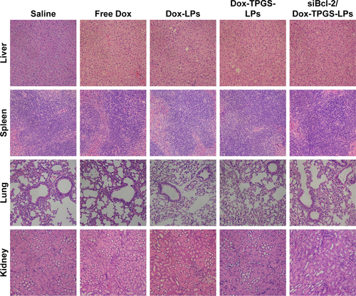 Figure S4 H&E-staining of liver, spleen, lung, and kidney extracted from the mice on Day 15 after treatment with various formulations.Abbreviations: Dox, doxorubicin; LPs, liposomes; siBcl-2, Bcl-2 siRNA; TPGS, D-α-tocopherol polyethylene glycol 1000 succinate.