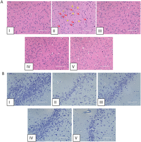 Figure 2 AFPR improved inflammatory infiltration of the prefrontal cortex and hippocampal neuronal damage in rats. (A) H&E staining (40×). (B) Nissl staining (40×). I: control group; II: model group; III: positive group; IV: high dose group; V: low dose group.
