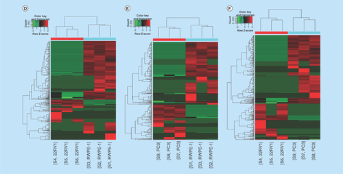 Figure 2.  Profiles of differentially expressed circular RNAs in prostate cancer cell lines.(A–C) The distribution of circRNAs from different catalogs in RWPE-1, 22RV1 and PC3 cell lines. (D–F) Hierarchical clusterings shown as the analysis of differential circRNAs in group 22RV1 versus RWPE-1, PC3 versus RWPE-1, PC3 versus 22RV1, where the red strips represent high relative expression, the green strips represent low relative expression and the dendrograms show the relationships between the samples and differential circRNAs, with the threshold of fold change 2.0 and p-value < 0.05. (G–I) The visualization of circRNAs between two conditions in group 22RV1 versus RWPE-1, PC3 versus RWPE-1, PC3 versus 22RV1, where the red rectangles represent differential expression of circRNAs with the threshold of fold change 2.0 and p-value < 0.05.