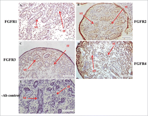 FIGURE 6. The expression patterns of FGFR1-4 at 17 d post coitum (dpc) in embryonic mice testis. The expression patterns of FGFR1 (A), FGFR2 (B), FGFR3 (C), and FGFR4 (D) at 17 dpc in mice testis were detected by immunohistochemistry. (E) represents control section without a primary antibody. The long arrow indicates the cell types as illustrated by the abbreviations: ST, seminiferous tubules and IT, interstitial region. Scale bar = 100 µm (200 ×).