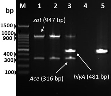 Figure 3 Multiplex-PCR analysis for zot, ace and hlyA. Lane M, 100 bp DNA ladder; lane 1, V. cholerae O1 Ogawa-Classical NIH41 (positive control for ctxA and tcpA gene); lane 2, negative control; lane 3, V. cholerae non-O1/O139 strain isolated from urine specimen.