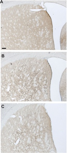 Figure 3 c-Fos expression in the dorsal striatum following armodafinil, methamphetamine, or saline injections.