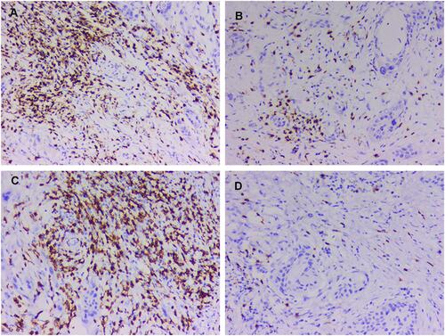 Figure 8 The densities of CD3+ (Mouse IL-1Ra Elisa kit, Kit-0003) and CD8+ (Anti-CD8 antibody, MAB-0021) T cells in the tumor core (TC) and invasive margin (IM) by immunohistochemistry. (A) The densities of CD3+ in IM (100x). (B) The densities of CD3+ in TC (100x). (C) The densities of CD8+ in IM (100x). (D) The densities of CD8+ in TC (100x).