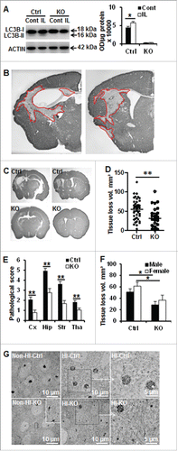 Figure 3. Neuronal Atg7 deficiency reduced hypoxia-ischemia-induced neuronal autophagy and brain injury. (A) Representative immunoblots of LC3BB from non-HI control (Cont) and HI ipsilateral (IL) hemispheres of Ctrl and atg7 KO mice 24 h after HI and the corresponding quantification of LC3BB-II showed that Atg7 deletion completely prevented HI-induced LC3BB-II increase, (*P < 0.05, n = 6/group). (B) Representative MAP2 staining in the ipsilateral hemisphere of the hippocampus (left) and striatum (right) level with the indication of MAP2 negative areas. (C) Representative MAP2 staining of coronal brain sections 8 d after HI at the levels of the dorsal hippocampus (left panels) and striatum (right panels) from Ctrl and atg7 KO mice and (D) measure of total tissue loss volume demonstrated a strong reduction of the lesion in the atg7 KO mice (Ctrl: n = 38, atg7 KO: n = 28), (**, P < 0.01). (E) Pathological scores performed in the cortex (Cx), hippocampus (Hip), striatum (Str), and thalamus (Tha) confirmed the greater resistance of atg7 KO mice compared to Ctrl mice, **, P < 0.01. (F) There was no difference in the neuroprotection provided by Atg7 deletion between males (Ctrl: n = 22, atg7 KO: n = 16) and females (Ctrl: n = 16, atg7 KO: n = 12) (*, P < 0.05). (G) The neuronal cell architecture in the Ctrl and atg7 KO mice in non-HI control and 24 h after HI indicated that dying neurons with condensed chromatin were more frequent in Ctrl than in atg7 KO. Squared areas are enlarged in the right panels. Moreover, the neuronal architecture was relatively well preserved in the atg7 KO mouse compared to that of the Ctrl mice. KO: atg7 KO (Atg7flox/flox; Nes-Cre) and Ctrl: Atg7flox/+; Nes-Cre.