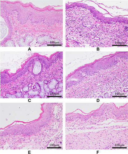 Figure 9 Histopathological examinations of the pharyngeal mucosal tissue of the rats from each group (HE, 200×). (A) Control group; (B) Model group; (C) FFZJF-L group; (D) FFZJF-M group; (E) FFZJF-H group; (F) AS group. It can be seen that the morphology of the pharyngeal tissues in the control group remain intact based on microscopy. In the model group, the mucous membrane appears necrotic, the submucosal layer shows swelling (edema), and many inflammatory cells are present. The inflammation is significantly reduced in the FFZJF treatment groups. As the dose of FFZJF increases, the condition of inflammation improved.
