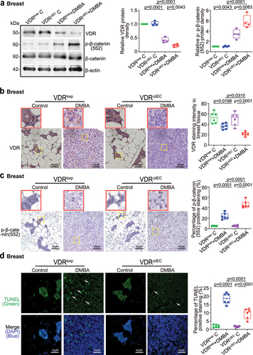 Figure 3. Intestinal epithelial VDR deletion led to decreased VDR expression, increased proliferation, and decreased apoptosis in breast tumor tissues. (a) Decreased VDR protein expression and increased p-β-catenin (Ser552) expression in mammary gland tumors of VDRΔIEC mice compared with VDRloxp mice. Data are expressed as the mean ± SD. N = 4, one-way ANOVA. (b) VDR was decreased in breast tumors of VDRΔIEC mice compared with VDRloxp mice by IHC staining. Images are from a single experiment and are representative of 6 mice per group. Red boxes indicate the selected area at higher magnification. (c) p-β-catenin (Ser552) expression increased in breast tissues of VDRΔIEC mice compared with VDRloxp mice by IHC staining. Images are from a single experiment and are representative of 6 mice per group. Red boxes indicate the selected area at higher magnification. (d) Apoptosis-positive cells were decreased in the breast tissue of VDRΔIEC mice compared with VDRloxp mice by TUNEL staining. Images are from a single experiment and are representative of 6 mice per group. All p values are shown in the figures.