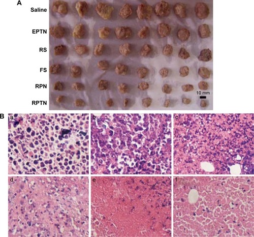 Figure 6 Images of therapeutic effect in vivo.Notes: (A) Morphology of all tumors isolated from the sacrificed mice in each group after 7 days of administration. (B) The six images are representative H&E staining of tumors. (B(a)–B(f)) The image of tumor treated with normal saline control, EPTN, RS, FS, RPN, and RPTN, respectively. The tissue slices were H&E stained and observed by microscope (×400).Abbreviations: H&E, hematoxylin and eosin; EPTN, empty poly(lactic-co-glycolic acid)-d-α-tocopheryl polyethylene glycol 1000 succinate nanoparticle; RS, Resibufogenin solution; FS, 5-fluorouracil solution; RPN, Resibufogenin-loaded poly(lactic-co-glycolic acid) nanoparticle; RPTN, Resibufogenin-loaded poly(lactic-co-glycolic acid)-d-α-tocopheryl polyethylene glycol 1000 succinate nanoparticle.
