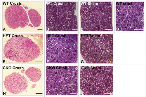 Figure 7. Qualitative effect of GDNF on sciatic nerve morphology on day 14 following crush injury. Representative digital light photomicrographs from the sciatic nerves of experimental mice 14 days following sciatic nerve crush injury at low (A, E, H) and high magnification (B, D, F, I) show a completely regenerated nerve segment in a GDNF WT mouse (A, B). Increased axonal density with clusters of numerous thinly myelinated regenerating axons (black arrows) are seen in another GDNF WT (D) and a HET (E, F) mouse compared to CKO mice (H, I) which is consistent with previous reports demonstrating a supportive role for GDNF in peripheral axonal regeneration following injury. Intact appearing endoneurial microvessels (white arrows) are shown in the regenerating WT (D) and HET (F) mouse sciatic nerves at higher magnification. Uninjured Sham surgery control nerves (C, G, J) from these mice are also shown. Scale bars = 50 µm (B, C, D, F, G, I, J) and 200 µm (A, E, H).