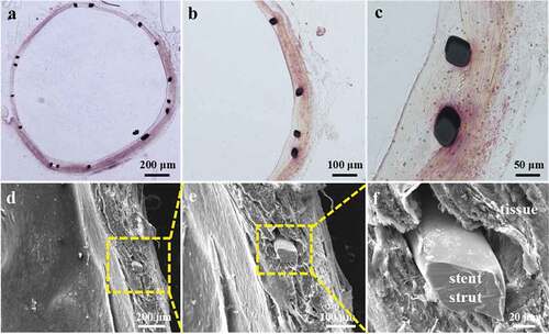 Figure 8. (a-c) H&E staining of stent samples after implanting in rabbit abdominal artery for 4 weeks, (d-f) stent strut encased in vascular tissue and the enlarged views (SEM).