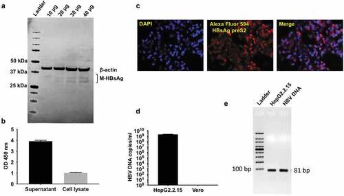 Figure 1. HBV virus amplification & characterization from HepG2.2.15 cells.