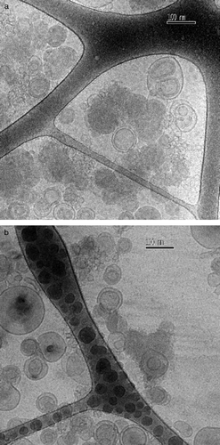 Figure 6.  Cryo-TEM micrographs of the ALA-DC complexes at the L/D = 4/1; (a) A/D = 2/1; (b) A/D = 10/1. Unperturbed liposomes coexisting with some of the formed complexes (denser and darker particles) are also seen. T = 25°C.