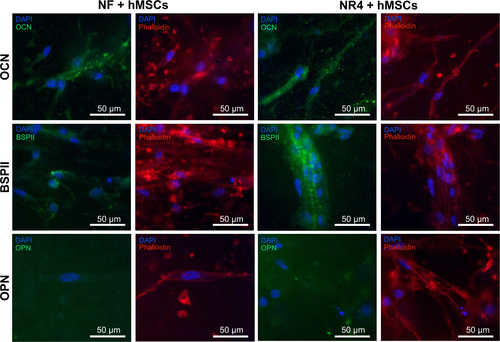 Figure S2 In vitro expression of OCN, OPN, and BSPII in hMSCs after 21 days of cell culture on bare PCL 3D scaffolds (NF) or those equipped with BMP-7 nanocontainers (NR4).Notes: Nucleus was stained with DAPI (in blue), actin-phalloidin (in red), and OCN, OPN, and BSPII were stained in green. For all images, scale bars =50 μm.Abbreviations: BSPII, bone sialoprotein II; hMSCs, human mesenchymal stem cells; NF, not functionalized; NR4, functionalized with (chitosan/BMP-7)4 nanocontainers; OCN, osteocalcin; OPN, osteopontin; PCL, poly(ε-caprolactone).