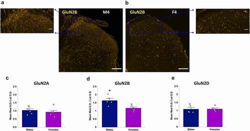 Figure 5. Comparison of the medial vs lateral OD ratio of GluN2 subunit isoforms between males and female rats. A, B) Representative confocal images showing GluN2B immunofluorescence in a male (a) and female rat (b), Scale bar: 200 μm, as well as higher magnification insets of the SDH for both male (top left) and female (top right), Scale bar: 50 μm. GluN2B signal is preferentially localized to the medial portion of the SDH in males (a) but not females (b). (c–e) Quantitative statistical analysis of the mean medial vs lateral OD ratio for GluN2A (c), GluN2B (d) and GluN2D (e) in males versus females. The medial/lateral ratio for GluN2B was significantly greater in males compared to females (d), while the medial/lateral ratio was not significantly different between males and females and near values of 1 for both GluN2A (c) and GluN2D (e). *p < 0.05