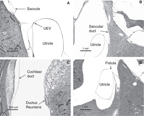Figure 2. Blockages or fistulae in normal ears. (A) Closed utriculo-endolymphatic valve. (B) Collapsed saccular duct. (C) Collapsed ductus reuniens. (D) Fistula between the utricle and perilymphatic space.