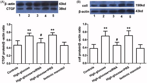 Figure 6. The effect of PRS-CTGF-siRNA on high glucose-induced CTGF and CoI1 protein expression in HKCs. The CTGF (A) and CoI1 (B) protein expression in HKCs cultured under 5.5 mm glucose (controls), 30 mm glucose (high glucose), high glucose + siRNA, high glucose + PRS and isotonic mannitol for 48 h. The protein expression determined by Western blotting; **p < 0.01 versus controls, #p < 0.05 versus high glucose group.