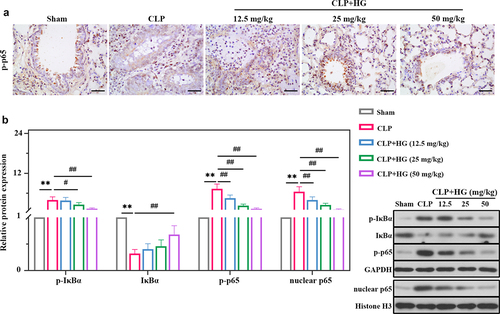 Figure 4. Hederagenin inhibits NF-κB signaling pathway in septic lung tissue. (a) Immunohistochemistry staining of p-p65 in the different groups after CLP (Original magnification ×400, scale bar 50 μm). (b) Protein expression levels of p-IκBα, IκBα, p-p65 and nuclear p65 in lung tissue were measured by western blot. Quantitative analysis of the blots was normalized to GAPDH or Histone H3. Results were presented as mean ± standard deviation, n = 6. **P < 0.01 versus Sham group; #P < 0.05 versus CLP group; ##P < 0.01 versus CLP group.