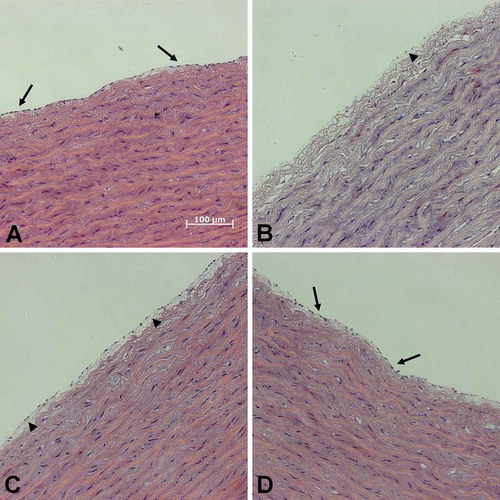 FIGURE 7. Integrity of porcine aorta segments after thawing.Segments of porcine aortae (control; A) were cryopreserved in cell culture medium (B), solution 1 (C) or solution 3 (chloride-poor; D), all supplemented with 10% DMSO. After quick thawing in a 37°C water bath segments were fixed. Sections were stained with haematoxylin and eosin. Arrows: intact endothelial monolayer; arrowheads: detached endothelium.