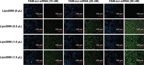 Figure S1 Optimization experiment of transfection efficiency for siRNA using FAM-scr-siRNA.
