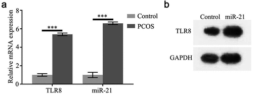 Figure 1. High expression of TLR8 and miR-21 in PCOS ovarian granulosa cells