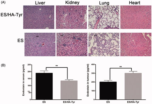 Figure 3. Systemic toxic side effects of ES/HA-Tyr evaluated in the tumor bearing mice. (A) Hematoxylin and eosin staining pictures of visceral tissue after ES and ES/HA-Tyr treatment, photographed (×200). (B) The concentration of ES in serum and tumor of mice in each group. Data are expressed as mean ± SD (n = 6). **p < .01. SD: standard deviation.