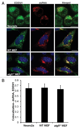 Figure 7. Replication intermediate dsRNA colocalizes with EDEM1 vesicles. (A) JEV-infected (MOI 5, 24 h) Neuro2a cells, WT, and atg5−/− MEFs were stained with EDEM1 (green) and dsRNA (red) antibodies. Merging of the 2 signals is shown in the right panels. (B) Pearson coefficient of colocalization between dsRNA and EDEM1. Scale bar: 10 µm.