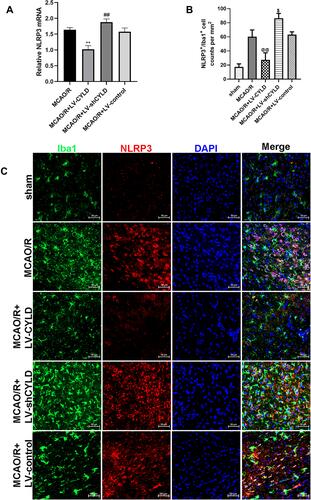 Figure 3 CYLD inhibits the NLRP3 inflammasome and microglial activation after 72 h reperfusion in rats. (A) NLRP3 mRNA expression were measured with RT-qPCR at 72 h reperfusion in the periischemic cortex (n=5). The graph shows the relative mRNA levels after normalization to the housekeeping gene β-actin. (B) NLRP3+/Iba+ cell counts were expressed as number/mm2. (C) Immunofluorescence staining showed co-expression of NLRP3 (red) and microglia (green, Iba 1) in the periischemic cortex (White arrows indicate co-expression between NLRP3 and microglia, scale bar = 50 µm, n=5). All values are presented as the means ± SEMs. **p<0.01, ##p<0.01,$p<0.05 and @@p<0.01 vs the MCAO/R group.