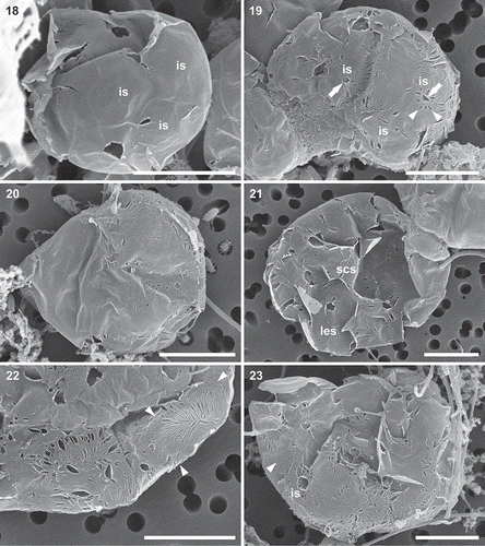 Figs 18–23. Wall components in globular auxospores; scanning electron microscopy. Fig. 18. Small, globular auxospore covered with relatively large, circular incunabular scales (is; only prominent scales labelled). Organic matter covering them obscures their structure. Fig. 19. Slightly larger auxospore with surface organic matter removed to expose ornamentation of scales (is; only prominent scales labelled), including annuli (arrows) and radial striations (arrowheads). Fig. 20. Relatively well preserved, intact anisometric auxospore, illustrating asymmetry in lateral view. Fig. 21. Globular auxospore with incunabular scales of various shapes and sizes. Prominent large elliptical scale (les) and small circular scale (scs) are indicated. Fig. 22. Part of the auxospore wall surface illustrating ribbed, long incunabular scales; one indicated by arrowheads. Fig. 23. Surface of an auxospore showing bands (arrowhead) overlapped by incunabular scales (is). Scale bars: Figs 18–23, 5 µm.