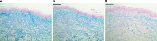 Figure 3 Epidermal and dermal mucin histology.